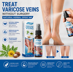 **South Moon Herbal Vein Care Spray β 30ml** πΏβ¨